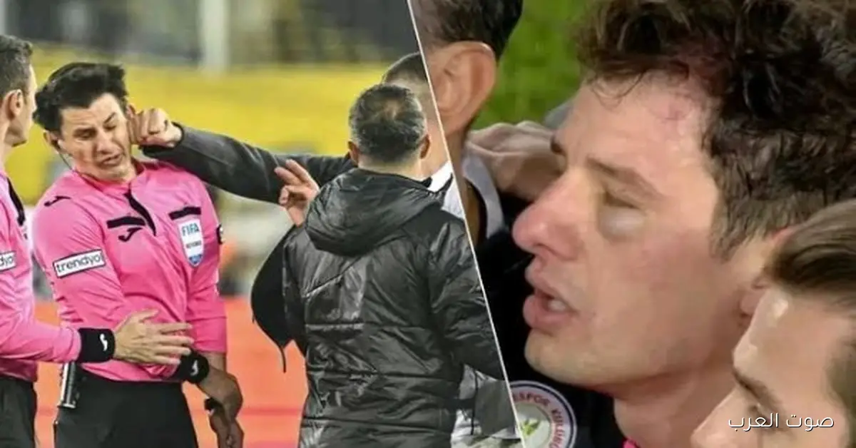 مضروب في وشه وممنوع في دوري روشن: 9 معلومات عن حكم مباراة السوبر