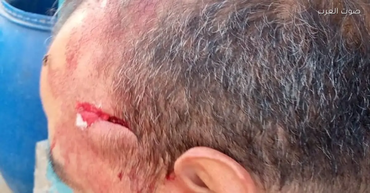 شخص يعتدي على معلم في مدرسة بالإسماعيلية