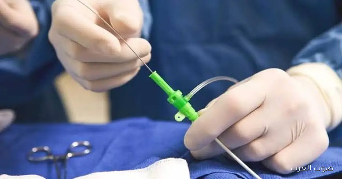 سيدة عندها 26 سنة.. تفاصيل تركيب 3 دعامات لمريضة في مستشفى طهطا بسوهاج