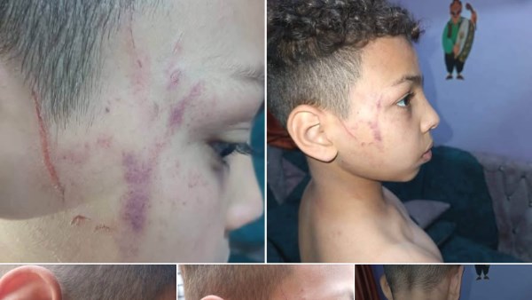 إيقاف معلمة في سوهاج بعد اعتدائها على تلميذ ابتدائي