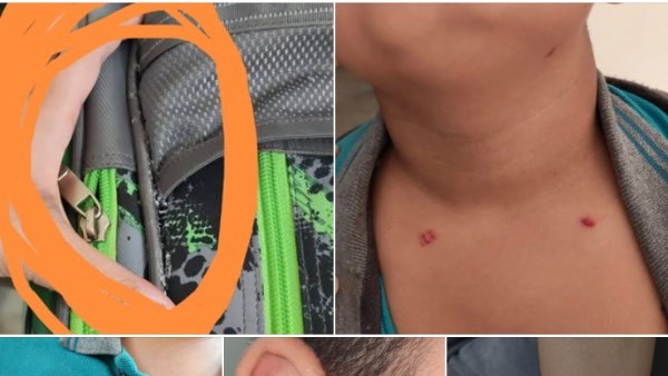 مدرسة الطالب المتعرض للضرب تنفي سلوكياته وألفاظه غير اللائقة