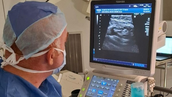 مستشفى بدر الجامعي يعالج نزيف مزمن لـ 3 سنوات بتقنية القسطرة التداخلية