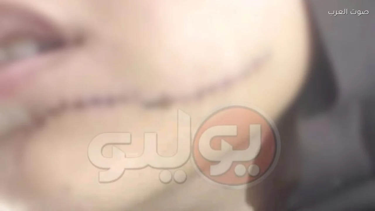 أسرة فتاة تكشف تفاصيل الاعتداء عليها داخل سيارة أجرة بالإسكندرية